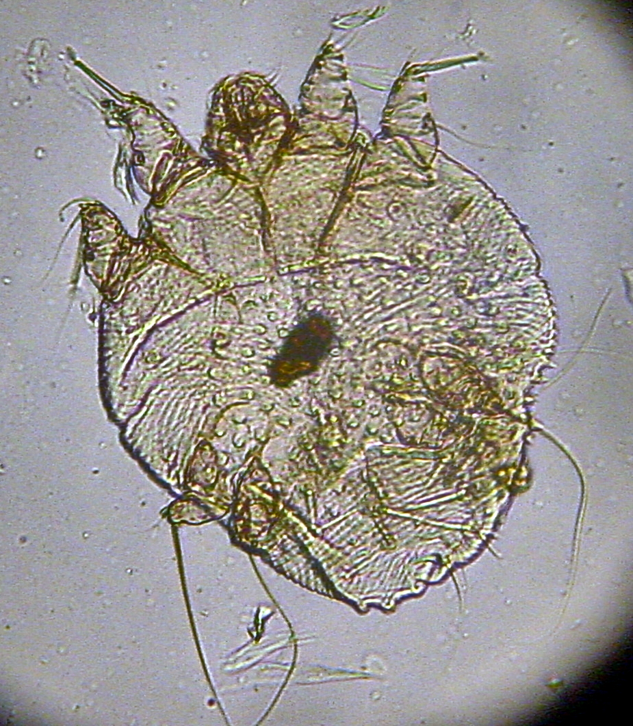 Photo of Itch mite